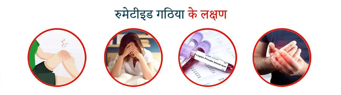 Signs of Rheumatoid Arthritis in Hindi